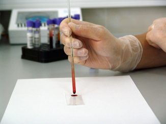 health blood sample
