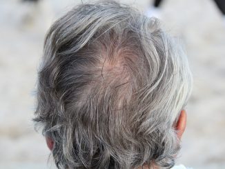 hair grey
